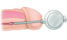 Oral medications