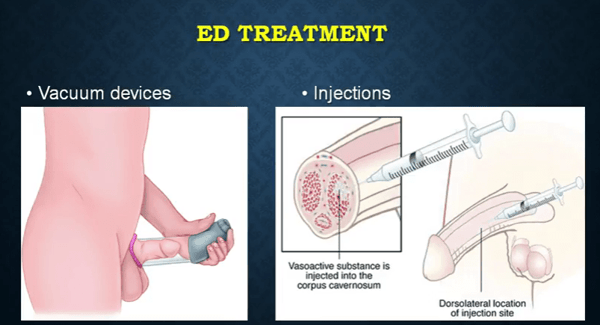 ed-treatment